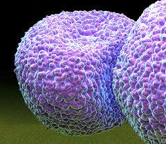 La Malattia Pneumococcica Lo Pneumococco o Streptococcus pneumoniae è un batterio molto diffuso che si ritrova comunemente nel tratto respiratorio superiore (rinofaringe) di bambini e adulti sani.