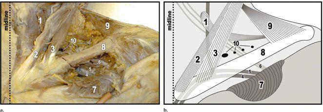 Cranio caudale: dal margine superiore del m.