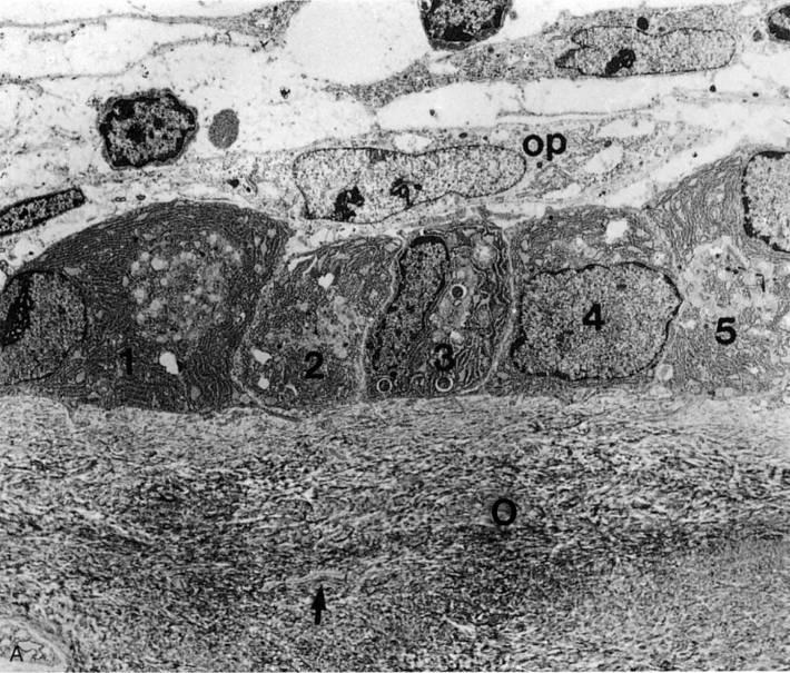 Osteoblasti Cellula osteoprogenitrice