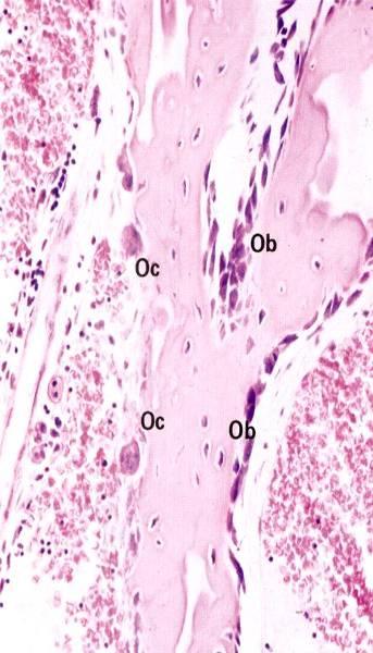 Rimodellamento delle Ossa Avviene durante tutta la vita, coinvolge gli Osteoclasti e gli Osteoblasti.