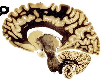 Cosciente Sensibilità propriocettiva Incosciente Figura tratta da: The Human