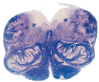 spinale Tronco encefalico