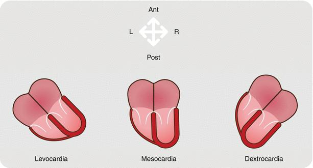 Approccio segmentario-sequenziale: I) posizione cardiaca e orientamento apice proiezione sottocostale Ø Per ciascusa delle posizioni