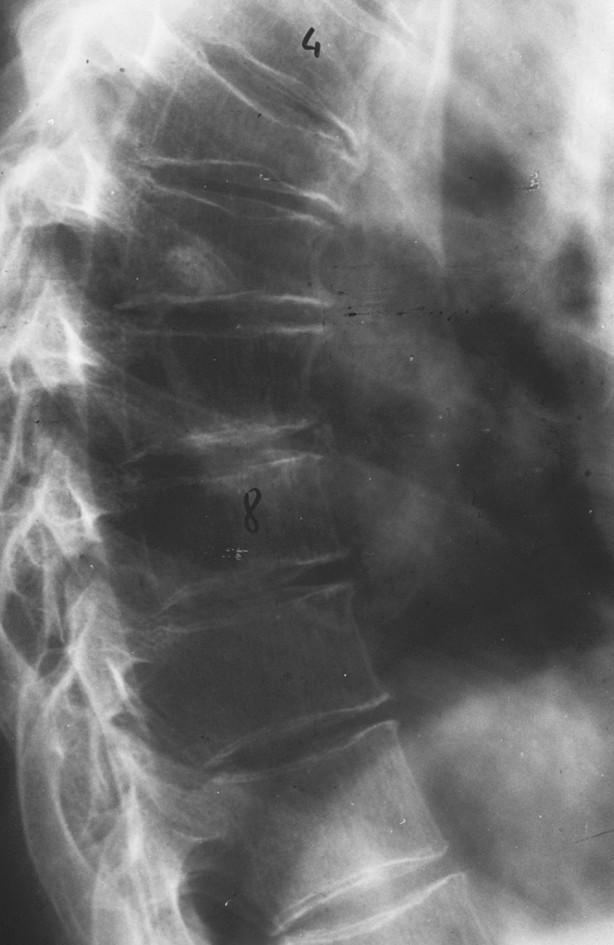 CASO CLINICO-RADIOLOGICO Rx