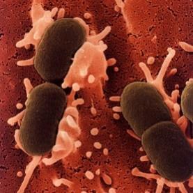 Enterobacteriaceae, coliformi E. coli Sono indice di contaminazione fecale e di corretta gestione dell igiene di produzione.