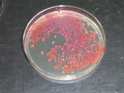 Enterobacteriaceae 2.