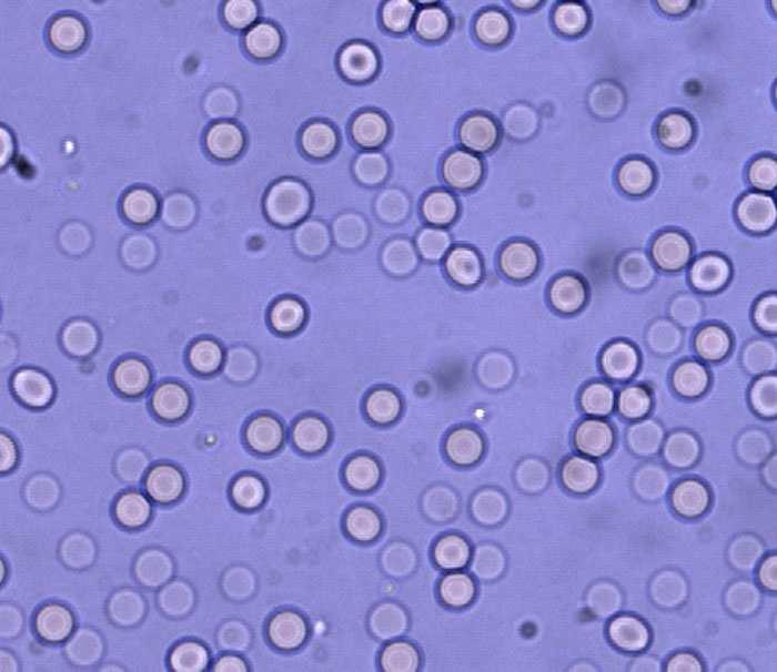 Globuli rossi diluiti in un mezzo ipotonico (pressione osmotica inferiore a quella del citoplasma : Cloruro di Sodio