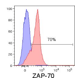 ZAP-70: a