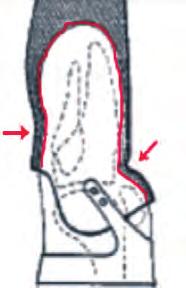 ginocchio. Il moncone si appoggia su questo tipo di invasatura principalmente in tre punti (Fig.1): 1) Sulla zona sottorutulea mediante una depressione dell'invaso in questo punto.