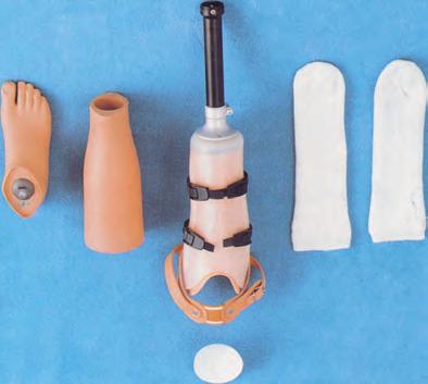 La compressione corretta e tempestiva del moncone ed una mobilizzazione precoce del paziente sono fondamentali per il successo della protesizzazione.