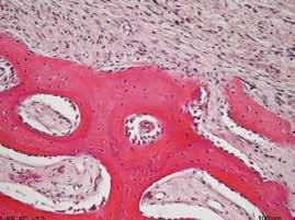 30 giorni dall innesto di osso RE-BONE / 30 days after implanting the RE-BONE bone graft Innesto all interno del seno mascellare di pecora al 30 giorno. Graft within a sheep s sinus on the 30th day.