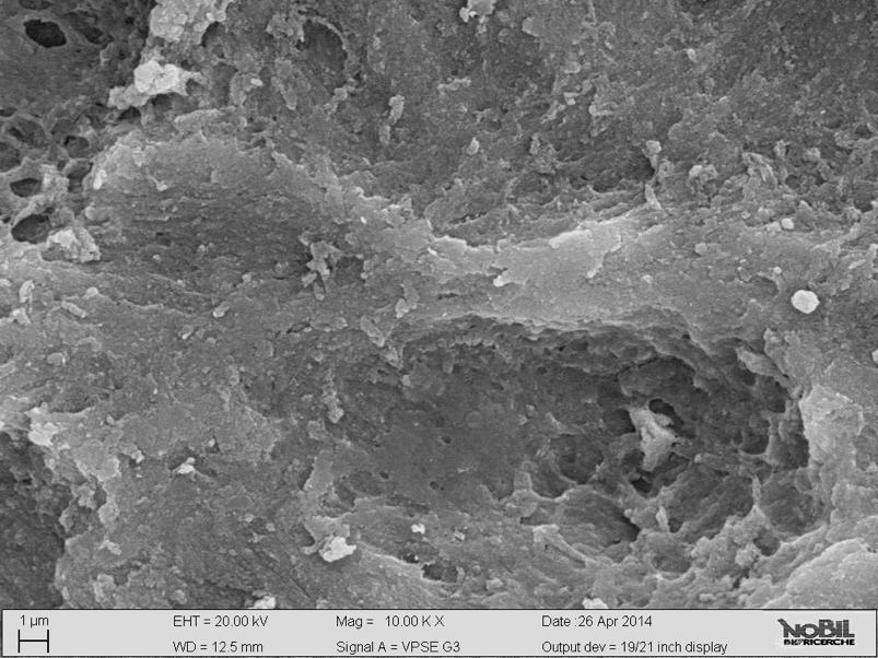 Aumentando la superficie di contatto dell innesto con le cellule del tessuto circostante si aumenta la probabilità di colonizzazione del biomateriale da parte delle cellule progenitrici ossee.