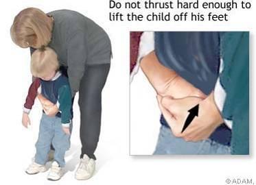 toracica, a livello epigastrico (sopra l ombelico) - afferrare la prima mano
