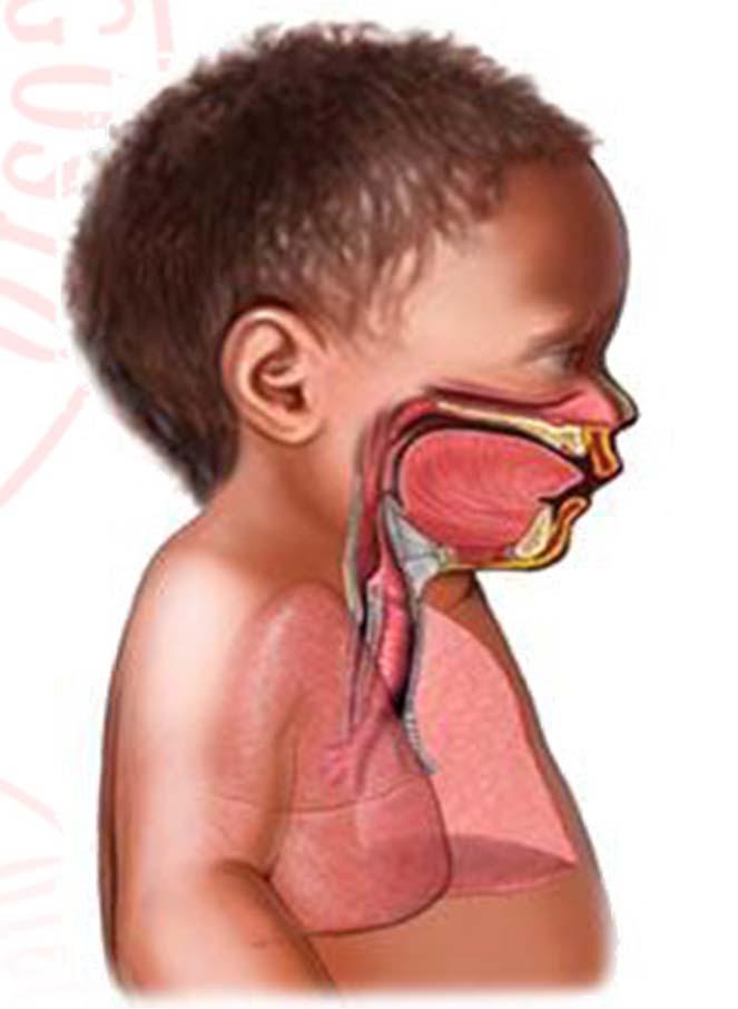 PBLS- ANATOMIA E FISIOLOGIA VIE RESPIRATORIE La LINGUA è più GRANDE: facile ostruzione delle vie aeree nel