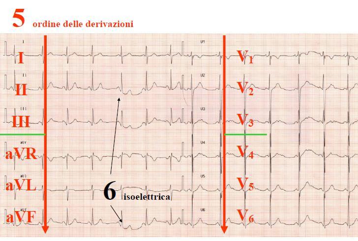 ELETTROCARDIOGRAMMA DATI