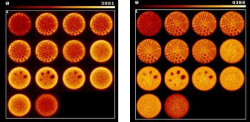 correzione per l'attenuazione metodo di Chang il metodo di Chang fornisce buoni risultati nel caso delle SPECT cerebrali