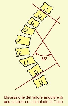 I muscoli obliqui, che sono compresi tra la colonna vertebrale e l'addome, intervengono sulle coste, che fungono da "intermediarie" tra il rachide e la parte anteriore del tronco.
