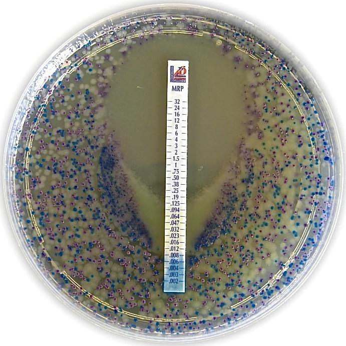 Chromatic TM MH plates. E. coli ATCC 25922 E. coli ATCC 25922 (reddish) P.