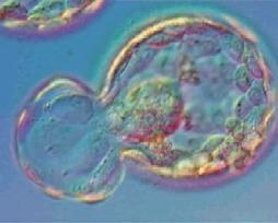 spermatozoi (ICSI); tale tecnica di micromanipolazione prevede l impiego del micromanipolatore, un microscopio ad elevato potere di risoluzione, che permette di raccogliere un singolo spermatozoo