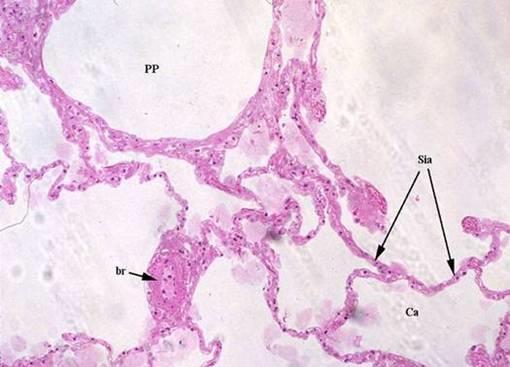 BRONCHI, dai DOTTI ALVEOLARI, dai SACCHI ALVEOLARI e dagli