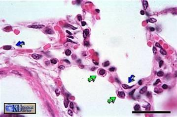 Sono coinvolte negli SCAMBI GASSOSI. - PNEUMOCITI di TIPO II (o di Secondo Ordine).