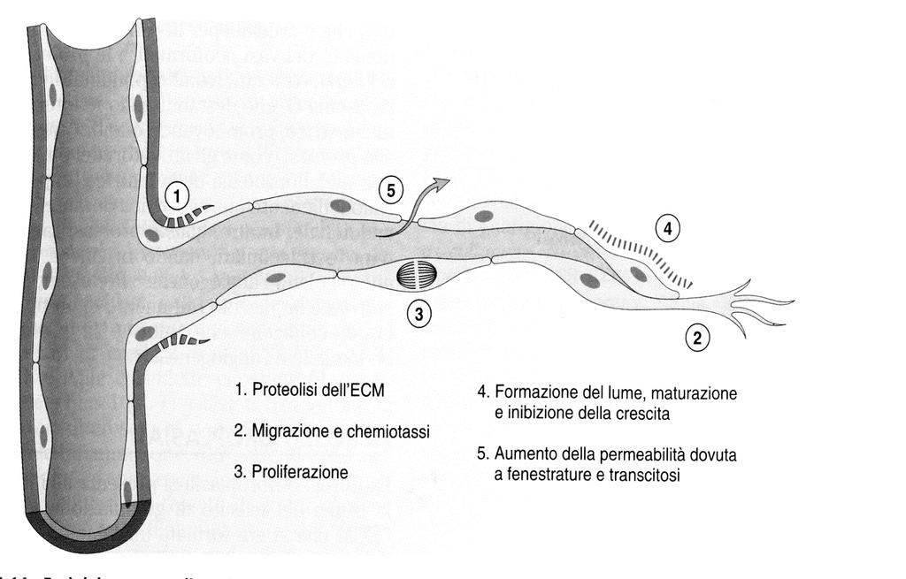 Angiogenesi VEGF (vascular endothelial growth factor): è il più importante fattore di crescita coinvolto, può essere