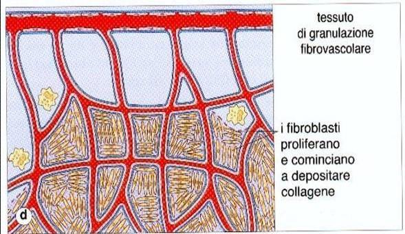 Fasi della guarigione delle ferite (3) I fibroblasti depongono collagene e fibre elastiche e parte di essi assume le caratteristiche di miofibroblasto (cellule muscolari lisce), contribuendo alla