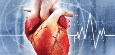 Il cuore è diviso in quattro camere: Un infarto è causato dal restringimento o dal blocco delle arterie coronarie che portano il sangue al cuore.