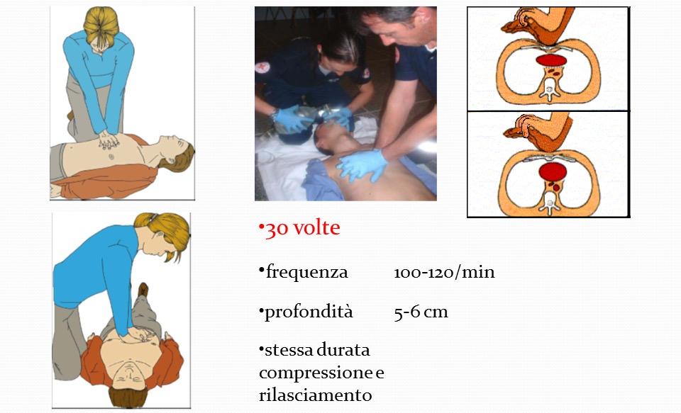 = MOVIMENTO, TOSSE, RESPIRO: MCE - Fase 2 MASSAGGIO