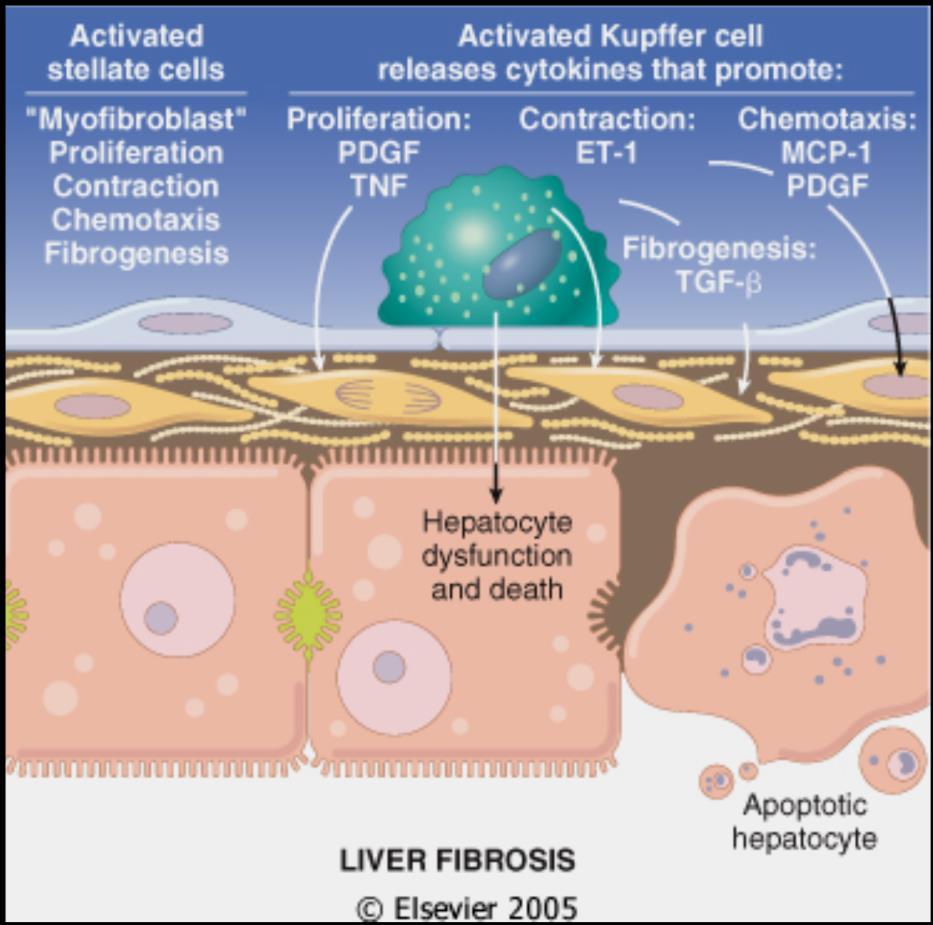 attivazione delle cellule stellate perdita gocce lipidiche fenotipo di miofibroblasti.