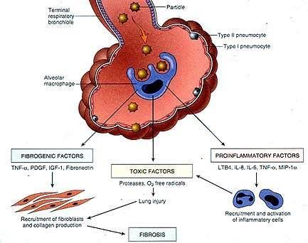 Agente lesivo Alveolite o Risposta Immunitaria Riparazione del danno alle cellule