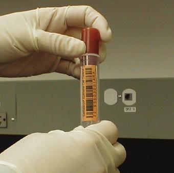 AVVERTENZE E PRECAUZIONI Per uso diagnostico in vitro Prima del test leggere interamente le istruzioni per l uso.