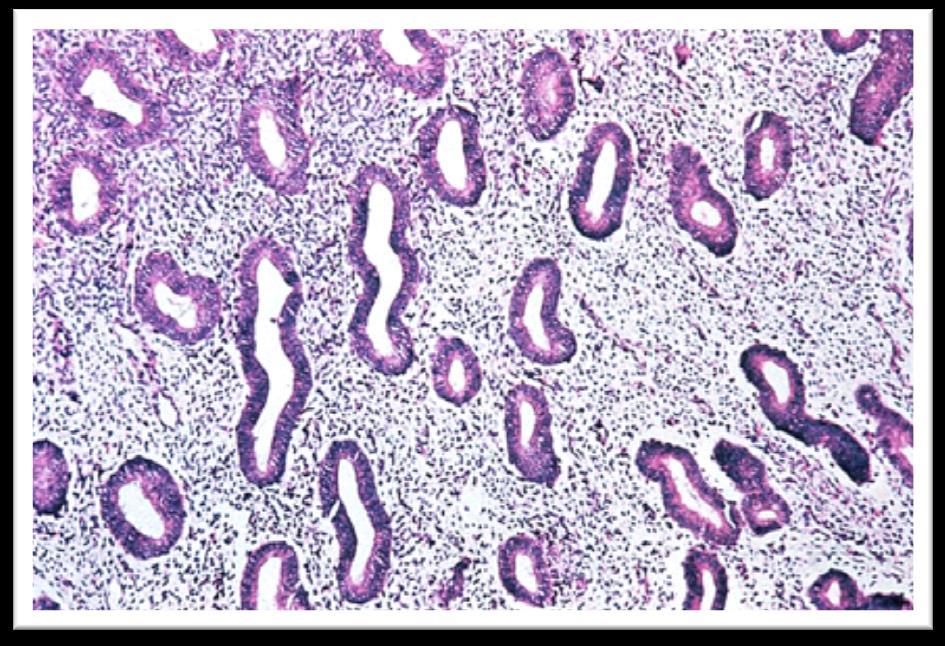 Endometrio proliferativo Note the straight