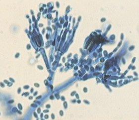 Deuteromiceti Funghi di cui non è ancora stato scoperto un ciclo