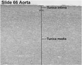 Struttura delle arterie di grosso calibro (di tipo elastico) Tonaca intima Spessore di circa 100 um formata da endotelio (cellule appiattite) che appoggia su uno strato sottoendoteliale,