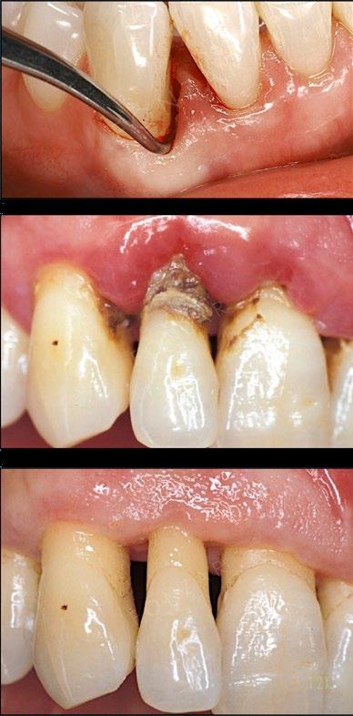 1 PRIMO INCONTRO: 14-15-16 MARZO (ANCHE PER IGIENISTI DENTALI) Dal controllo dell infezione e dei fattori di rischio alla formulazione del progetto terapeutico: il piano di trattamento definitivo.