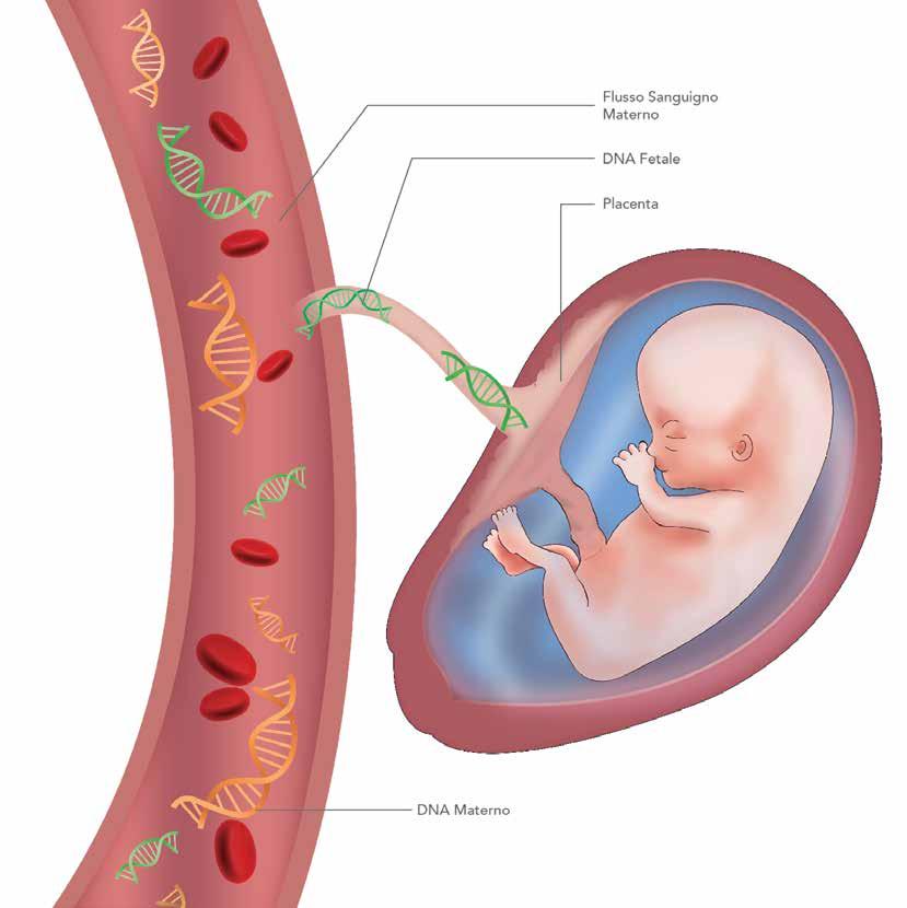 Screening sul DNA fetale libero circolante L unico metodo non invasivo basato sull analisi del DNA DNA fetale circolante Nel flusso sanguigno di ogni individuo sono presenti piccoli frammenti di