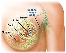 valutazione appropriatezza Stadio I tumore < 2 cm % donne con tumore