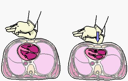 Tecnica compressione-rilascio 4-5 cm RILASCIARE TOTALMENTE LA PRESSIONE COMPRESSIONE :