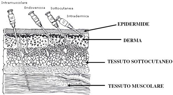 Vie Parenterali iniettive Intravascolare