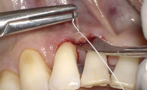 Applicazione delle metodiche chirurgiche su