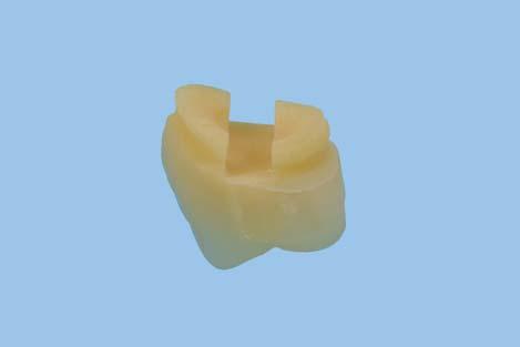 La resina viene fornita in cartucce, per cui è da escludere la possibilità di errori di miscelazione, che influiscono negativamente sulla qualità del materiale e - da ultimo - sulla protesi finita. 2.