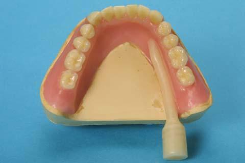 All atto del montaggio/posizionamento definitivo i denti in resina dovrebbero presentare una distanza minima di 1,5 mm. dal modello/cresta alveolare. 5.