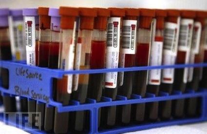 Domanda 16: Test addizionali ultimati prima del rilascio del sangue entro 10 min Immediate