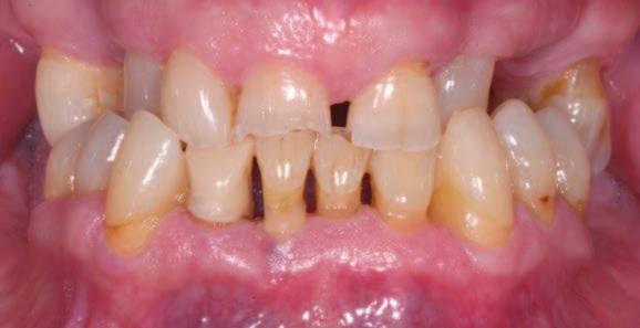 11-13_Foto intraorali: visione frontale e laterali del paziente a bocca chiusa.