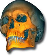 migliora il valore diagnostico delle radiografie. Sono anche incluse funzionalità di stampa versatili, nonché per l importazione e l esportazione delle immagini.