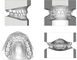 Planmeca Romexis Strumenti 3D per gli ortodontisti ed i laboratori odontotecnici Planmeca Romexis 3D Ortho Studio offre strumenti innovativi per gli ortodontisti e i laboratori odontotecnici.