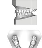 anche per la pianificazione dei trattamenti ortodontici in 3D.
