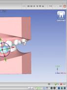 staffe. Le immagini acquisite possono essere utilizzate per la progettazione dei bracci. Il protocollo di acquisizione immagini dell apparecchio è ottimizzato per l uso con suresmile.