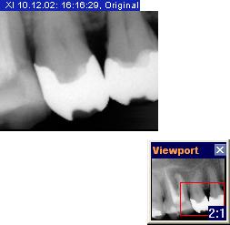 3 Uso Sirona Dental Systems GmbH 3.7 Strumenti di analisi 3.7.4.